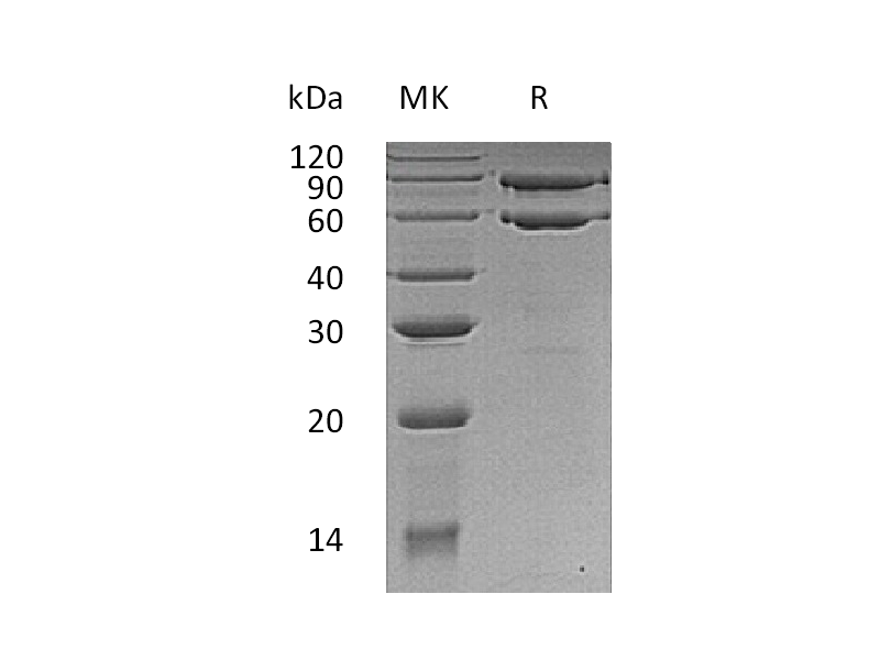 Recombinant Human COL8A1 (C-6His)
