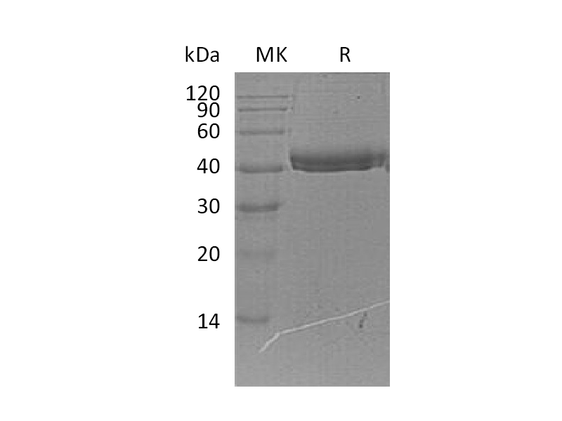 Recombinant Human COL9A1 (C-6His)