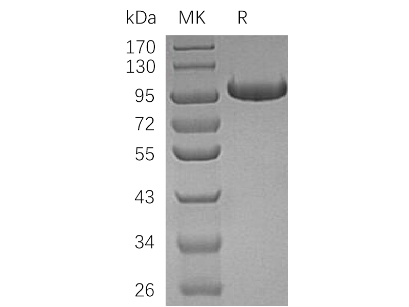 Recombinant Human CFB (C-6His)