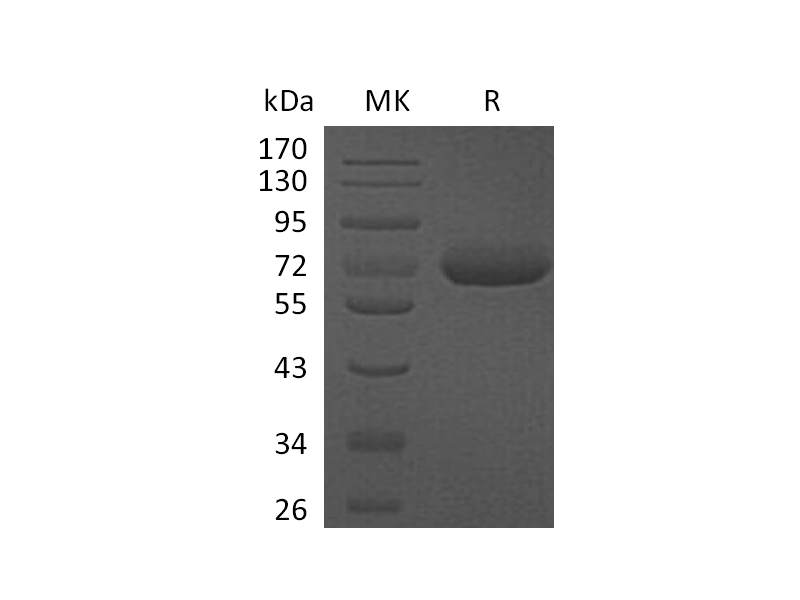 Recombinant Human CFHR5 (C-6His)