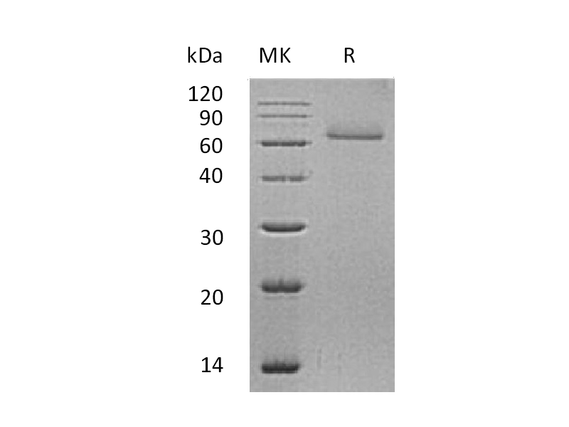 Recombinant Human CDSN (C-6His)