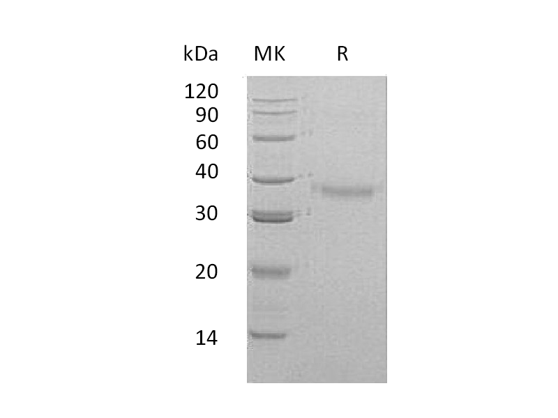 Recombinant Human CRHBP (C-6His)