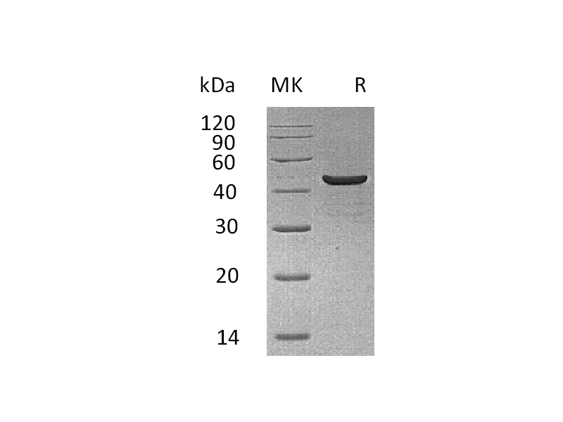 Recombinant Human CKMM (C-6His)