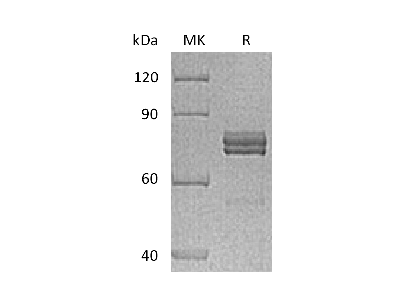 Recombinant Human CTGF (C-Fc)