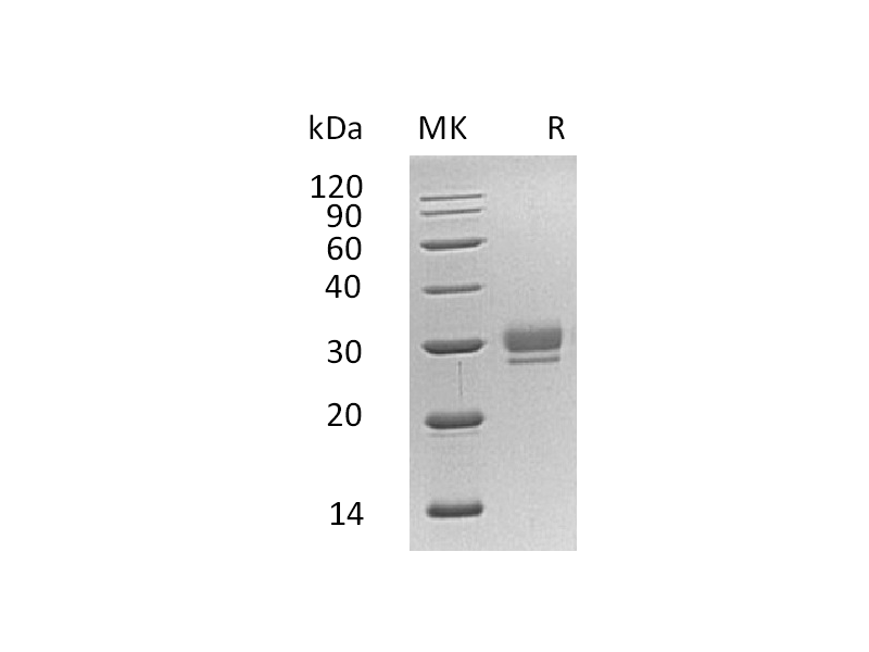 Recombinant Human CTHRC1 (C-6His)