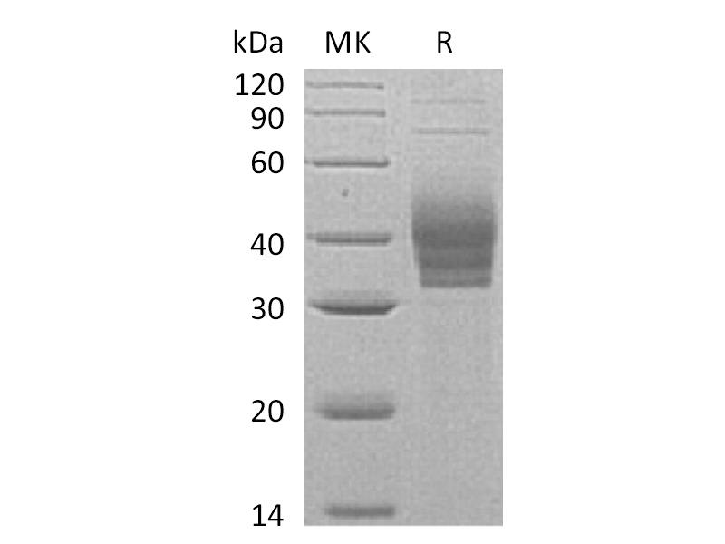 Recombinant Human CLEC4E (C-6His)