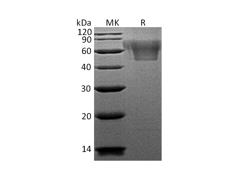 Recombinant Human CX3CL1 (C-6His)