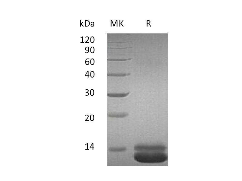 Recombinant Human CXCL1 (C-6His)
