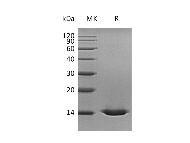 Recombinant Human CST5 (C-6His)