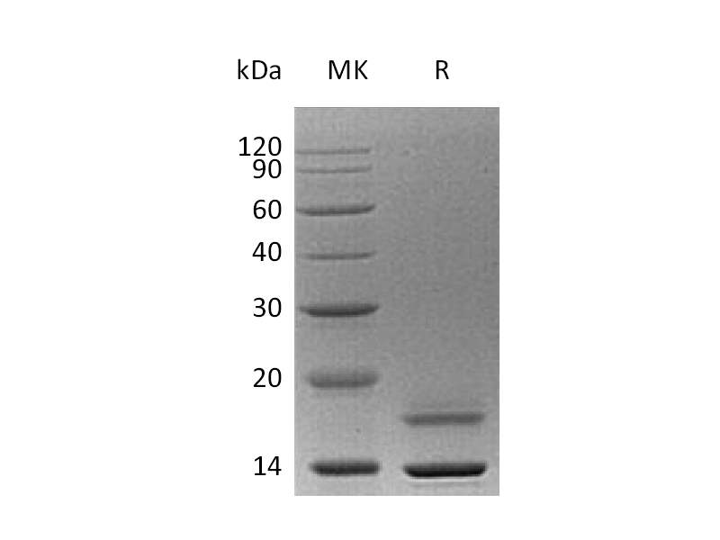 Recombinant Human CST6 (C-6His)