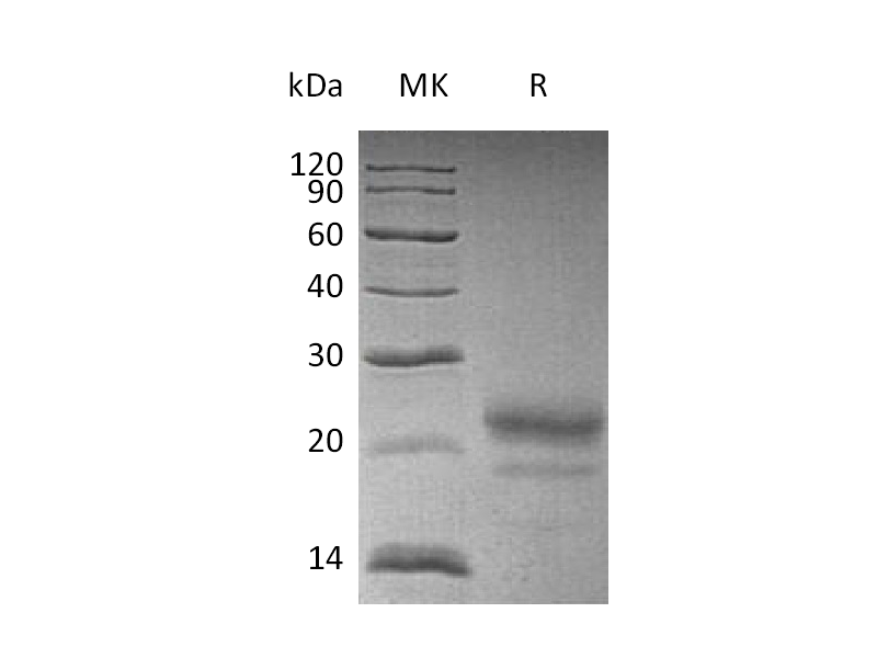 Recombinant Human CST7 (C-6His)