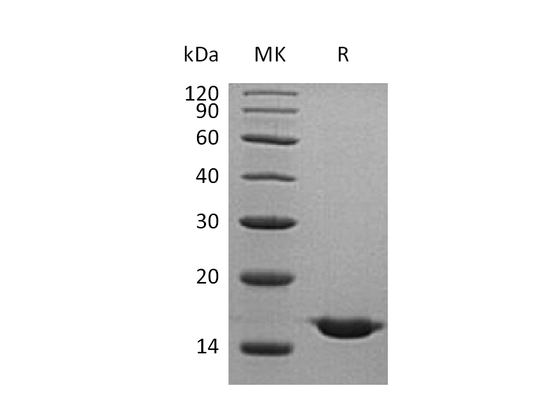 Recombinant Human CST2 (C-6His)