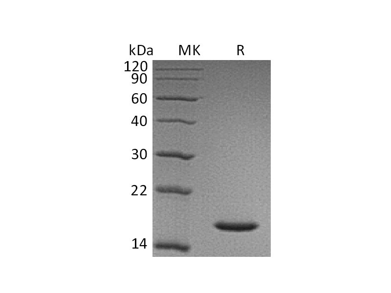 Recombinant Human CST1 (C-6His)