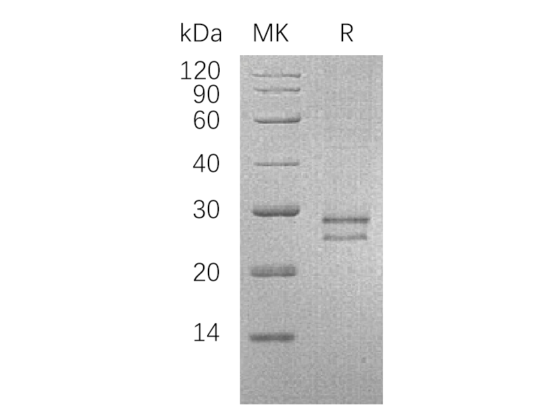 Recombinant Human CRISP-3 (C-6His)