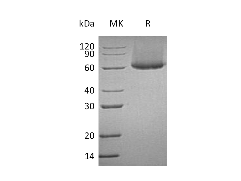 Recombinant Human CRTAM (C-6His)