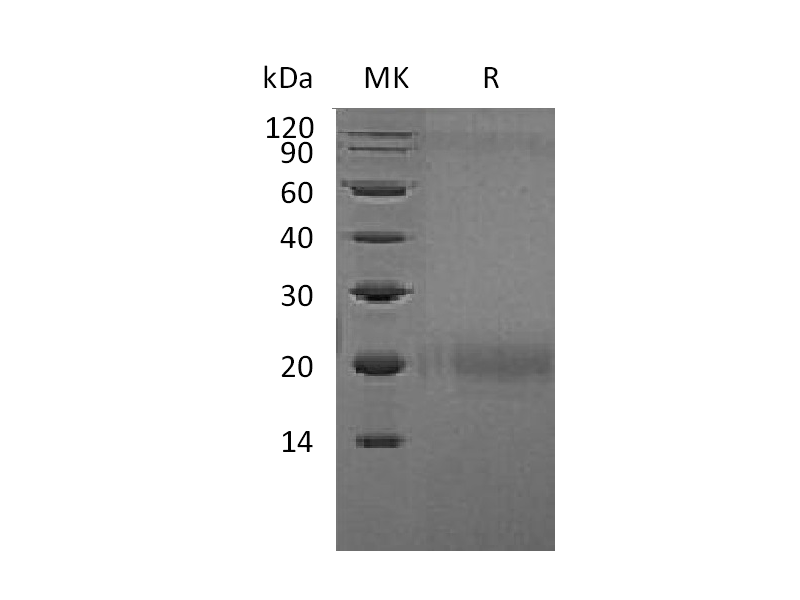 Recombinant Human CTLA-4 (C-Flag)