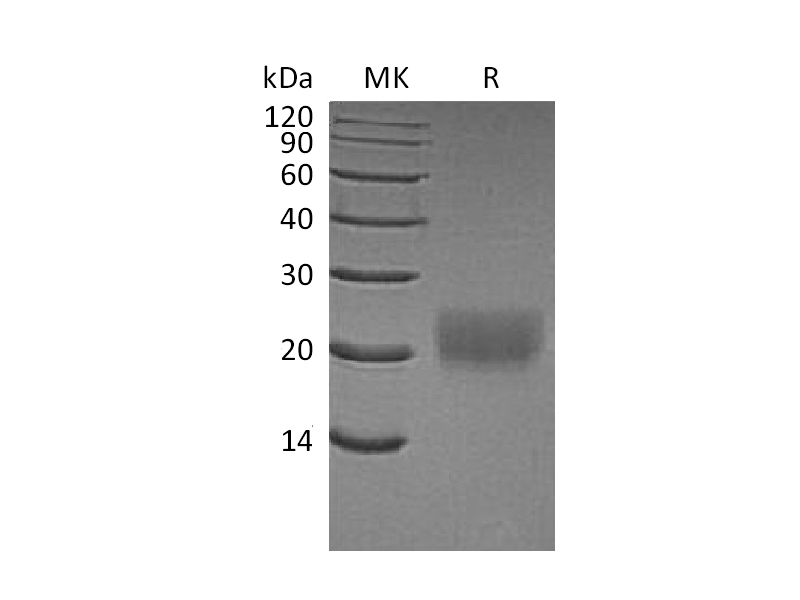 Recombinant Human CTLA-4 (C-6His)