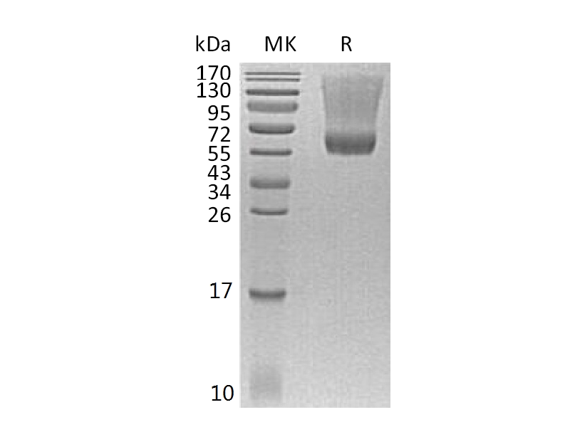 Recombinant Human Decorin (C-6His)