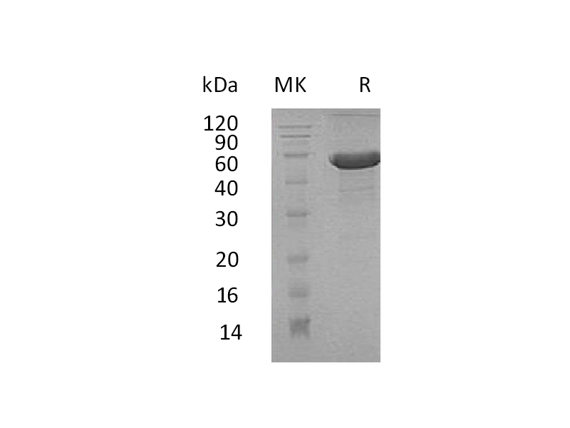 Recombinant Human DPT (C-Fc-6His)