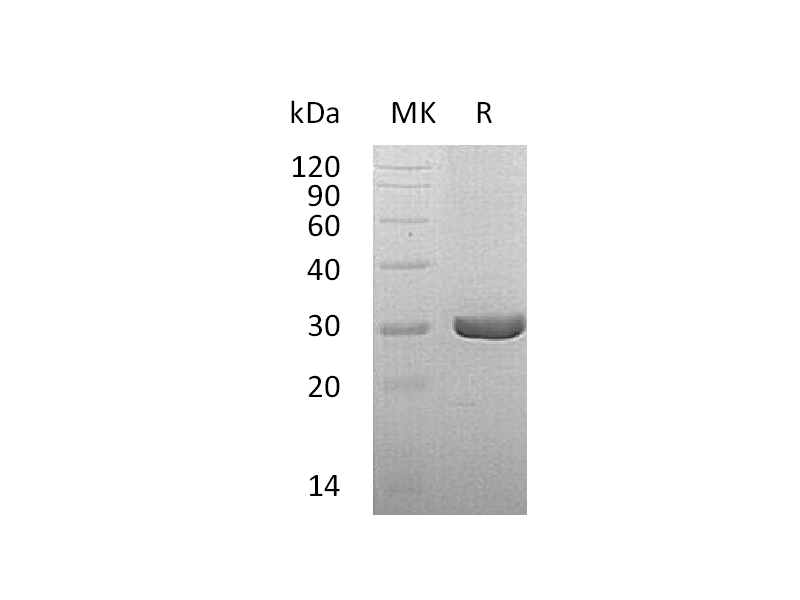Recombinant Human QDPR (C-6His)