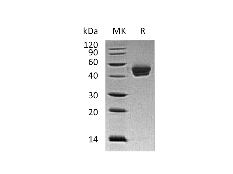 Recombinant Human DPEP1 (C-6His)