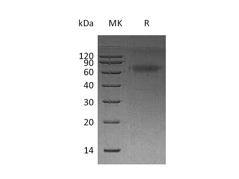 Recombinant Human DKK-3 (C-6His)