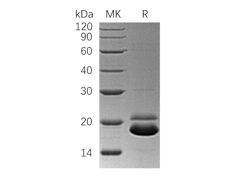 Recombinant Human TRAIL R2 (C-6His)