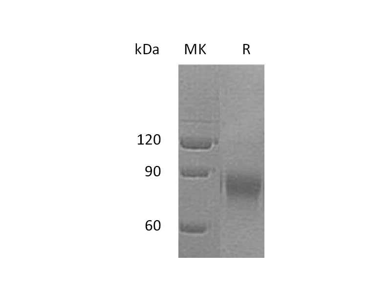 Recombinant Human DR6 (C-Fc)