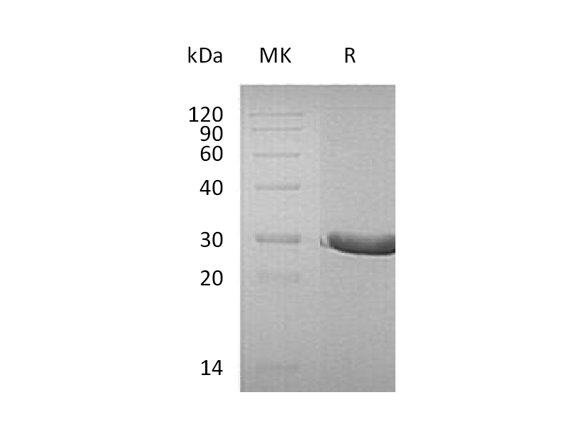 Recombinant Human DTD1 (C-6His)