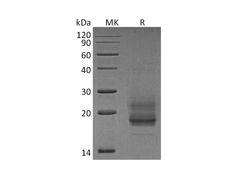 Recombinant Human CD69 (N-8His)