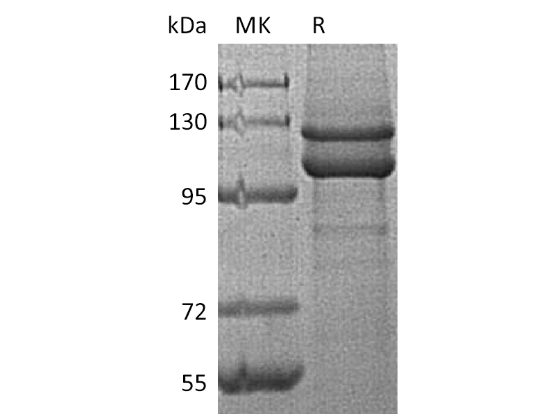 Recombinant Human CDH1 (C-6His)