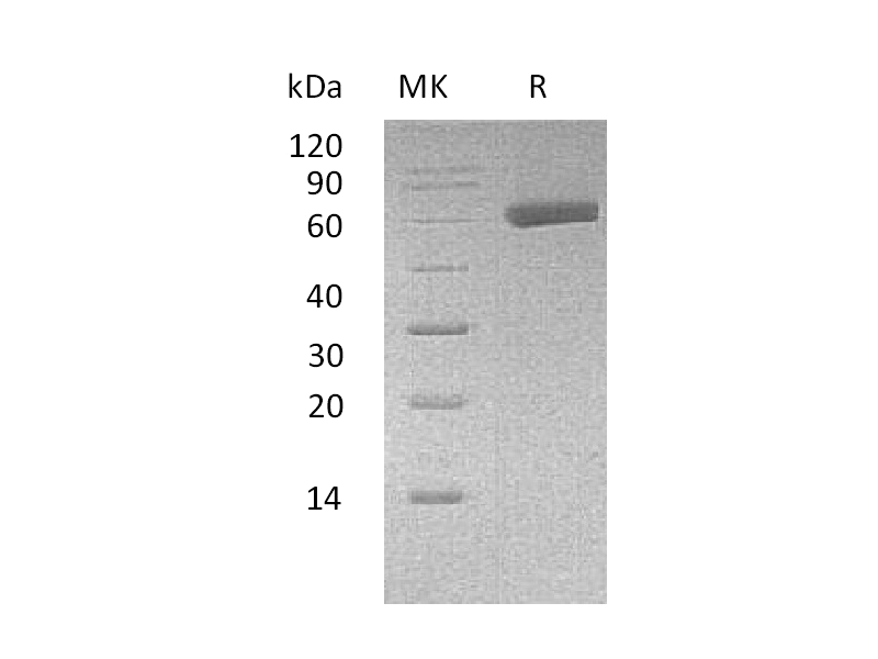 Recombinant Human EDIL3 (C-6His)