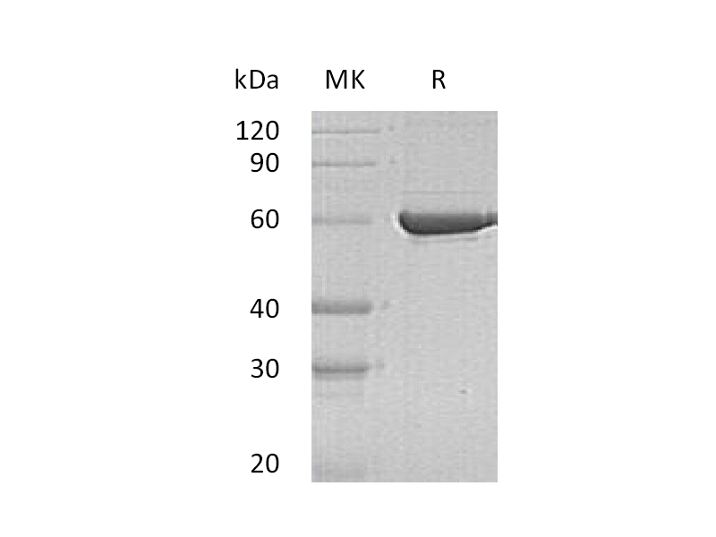 Recombinant Human PKLR (C-6His)