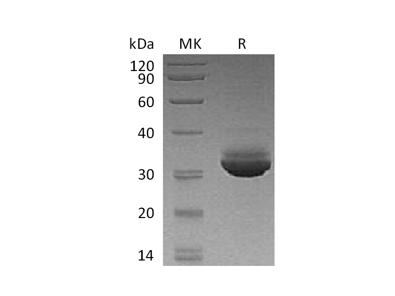 Recombinant Human CELA3A (C-6His)