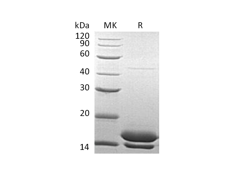 Recombinant Human Elafin (C-6His)