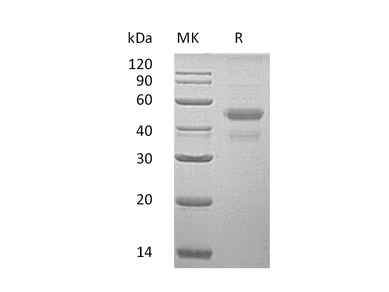 Recombinant Human ERp44 (C-6His)
