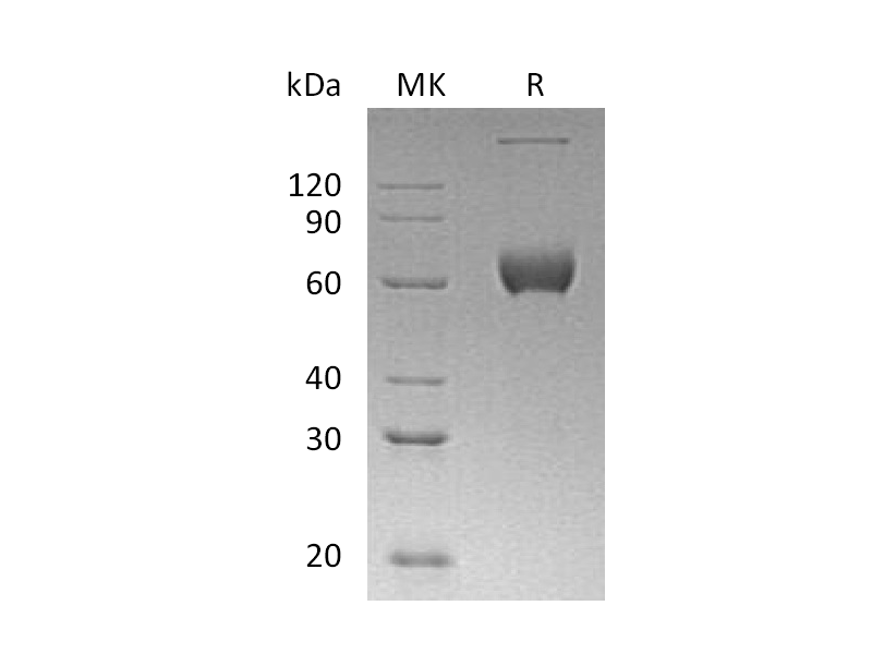 Recombinant Human ESAM (C-Fc)