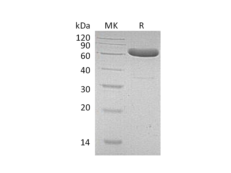 Recombinant Human EpCAM (C-Fc)