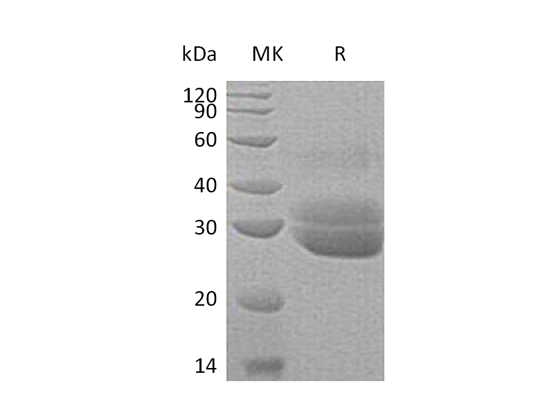 Recombinant Human EPDR1 (C-6His)