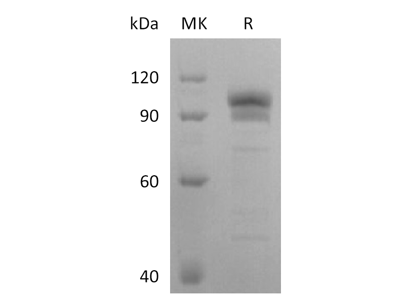 Recombinant Human EphB2 (C-Fc)