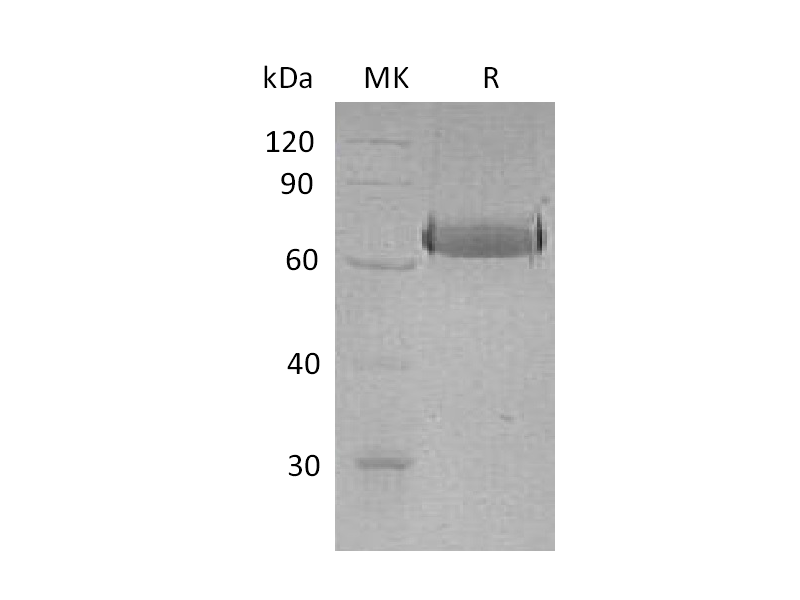 Recombinant Human EphA2 (C-6His)
