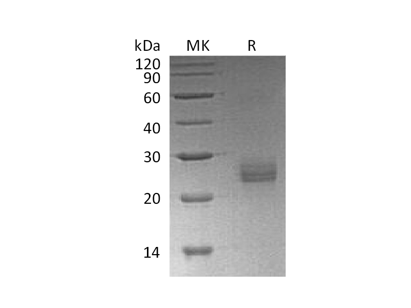 Recombinant Human Ephrin-A1 (C-6His)