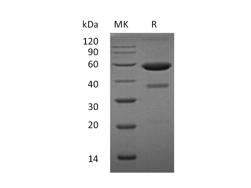 Recombinant Human EFNA1 (C-Fc)