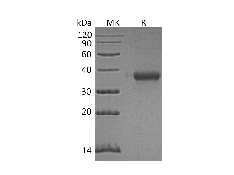 Recombinant Human EFNA3 (C-6His)