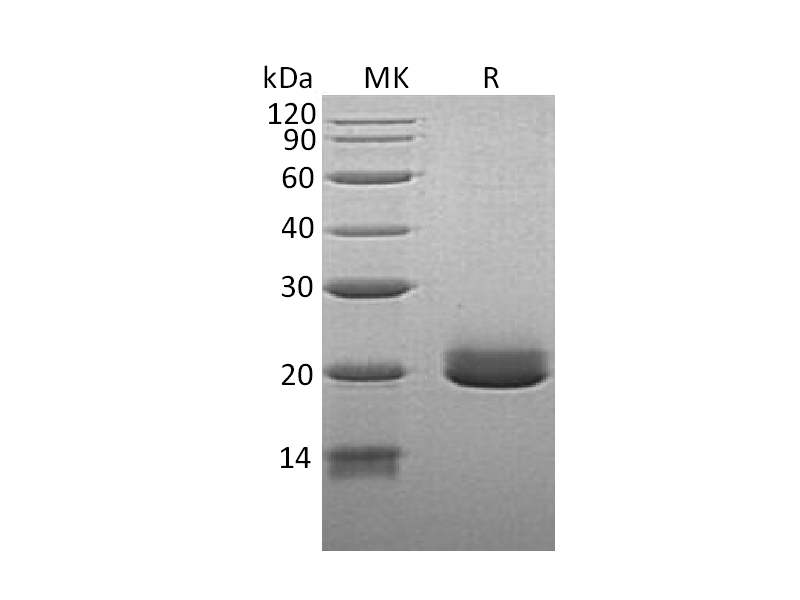 Recombinant Human EFNA4 (C-6His)