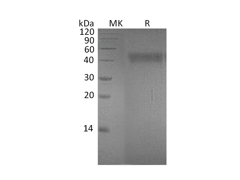 Recombinant Human EFNA4 (C-Fc-6His)