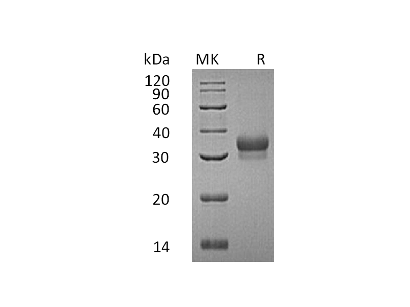 Recombinant Human EFNB1 (C-6His)