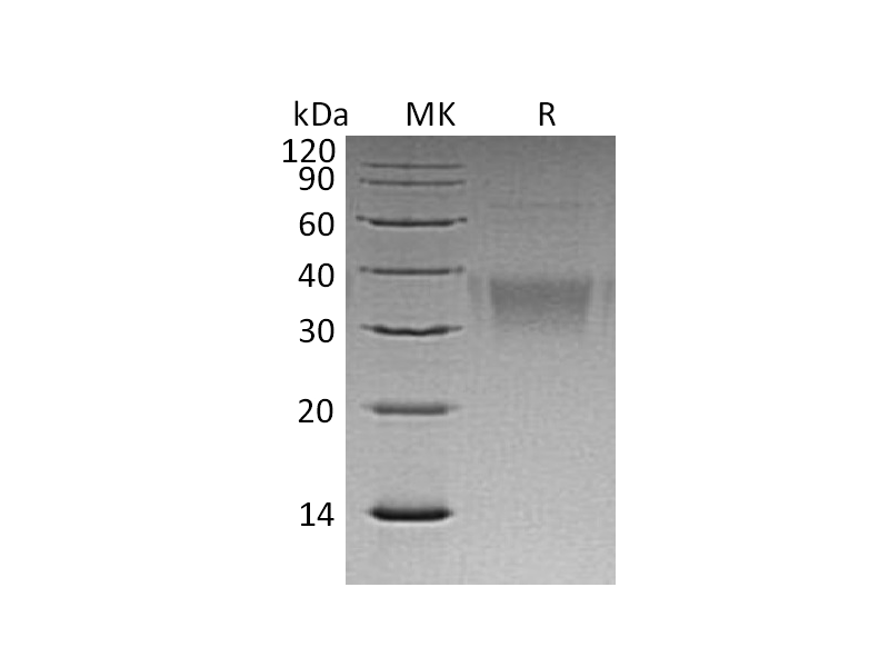 Recombinant Human EFNB2 (C-6His)