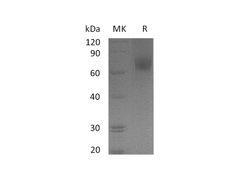 Recombinant Human EGFR vIII (C-6His)