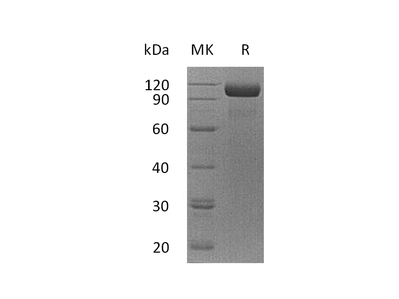 Recombinant Human EGFR vIII  (C-Fc)